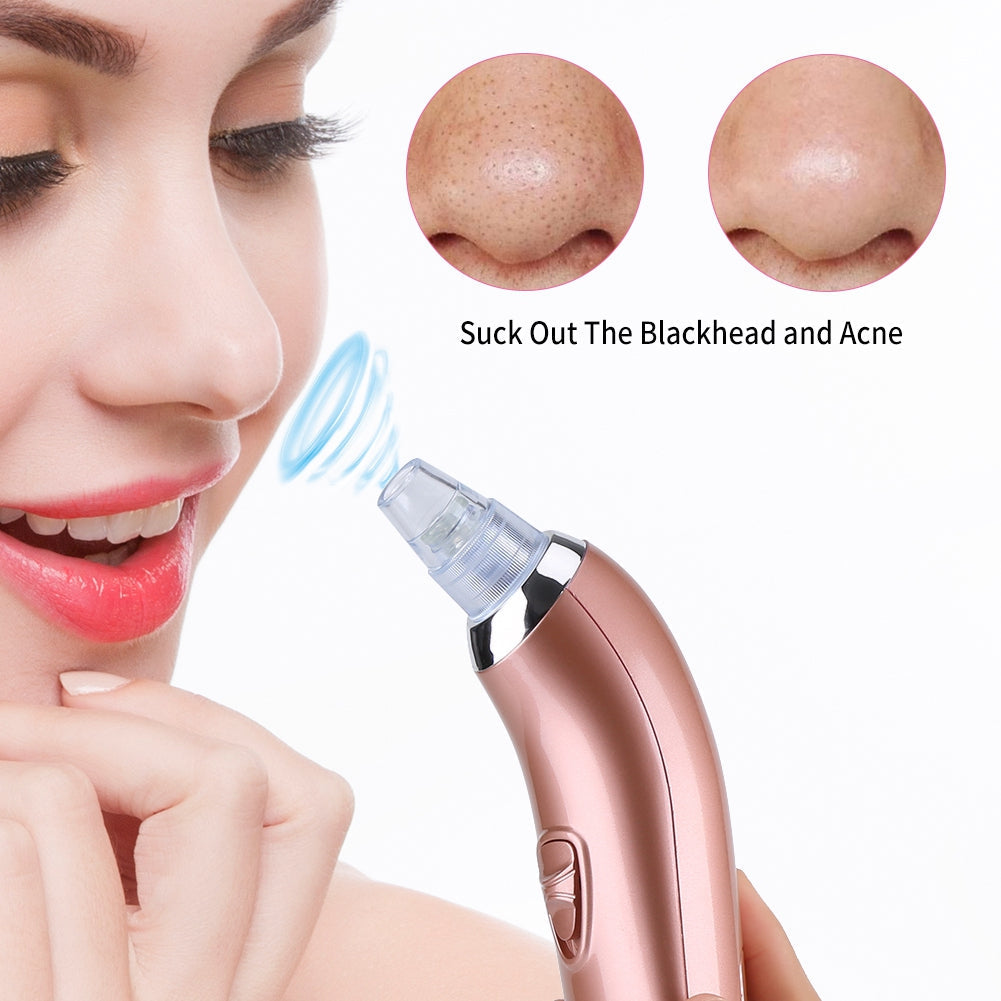 Electric Vacuum Suction Facial Blackhead Remover